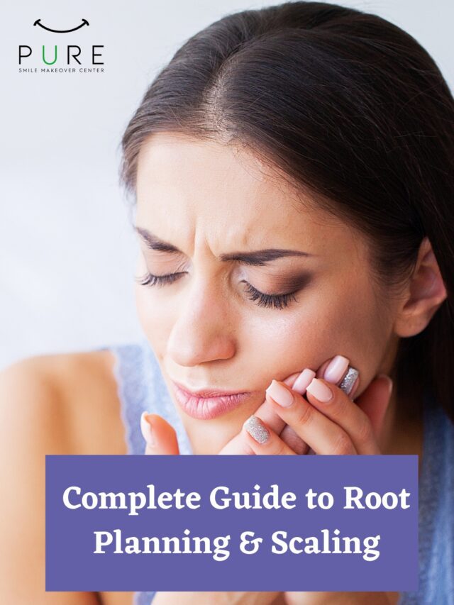 cropped-Complete-Guide-to-Root-Planning-Scaling-1.jpg