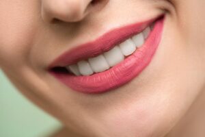 a woman smiling with bright, white teeth