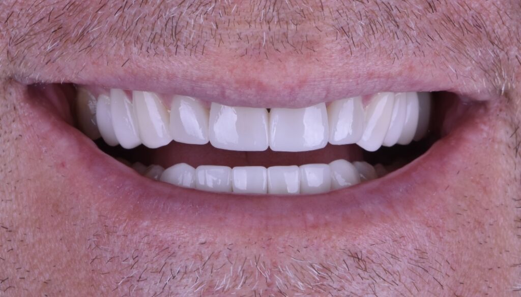 smile showing healthy straight white teeth